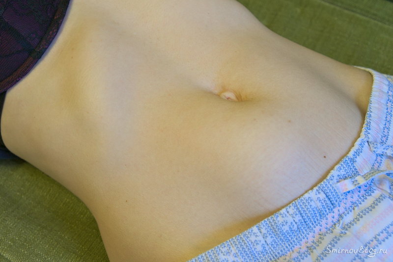 Множественная миома матки больших размеров - моя история Множественная миома матки, выпирающая через живот